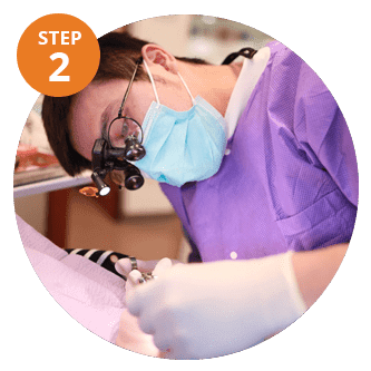 Treatment Process veneers before and after